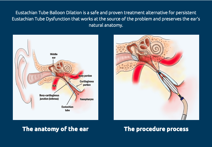 Anatomy of the Ear and Procedure Process